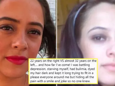 Hazel Keech Takes #10YearChallenge To Admit She Had Depression And She Would Starve Herself