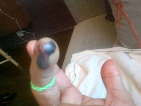 Sachin's finger