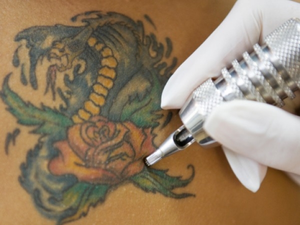Tattoo Infections Linked To Manufacturers' Ink