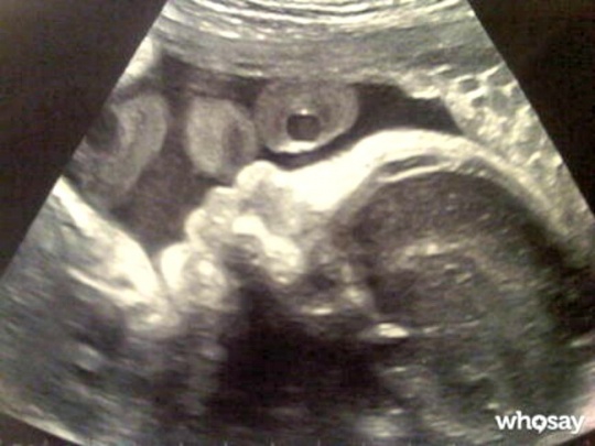 Shakira''s boyfriend tweets ultrasound scan of unborn son