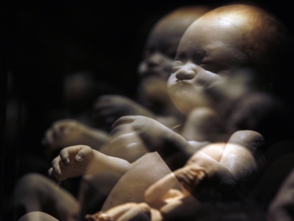 4D Scans Show Fetuses Yawn In The Womb