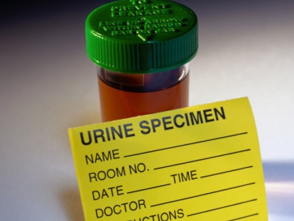 What Does Your Urine Colour Indicate?