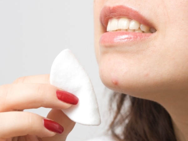 Skin Care: 10 Summer Tips For Acne