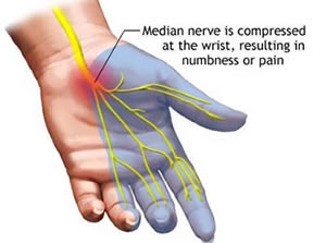 Understanding Peripheral Nerves : Types, Peripheral Neuropathy, Symptoms And Tests
