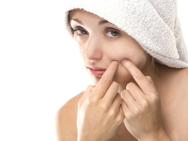 Skincare: Dealing With Dry Skin Acne