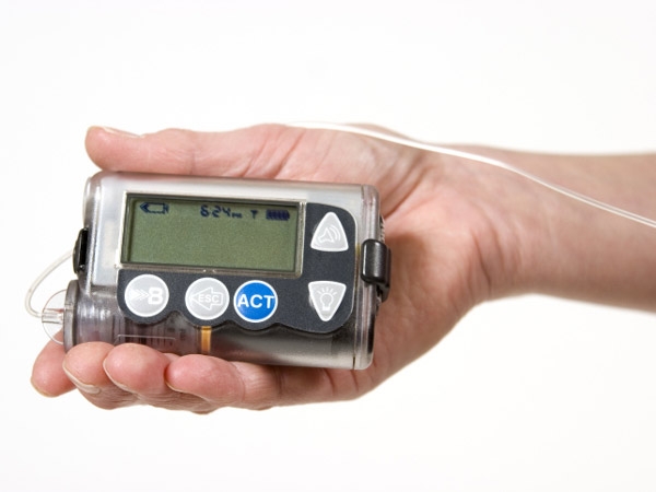 Diabetes Treatment: Pros And Cons Of Insulin Pumps