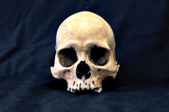Dogs Offer Clues to Human Skull Development