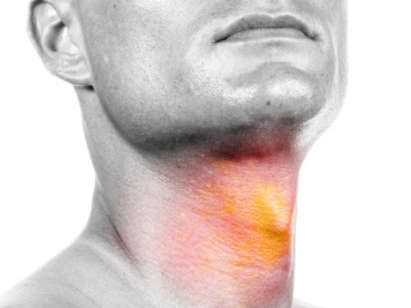 Risk Factors For Throat Cancer