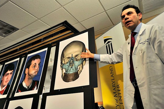 Human Head Transplant is Possible: Italian Neurosurgeon