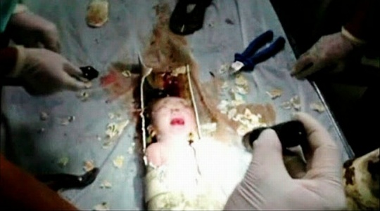 China newborn rescued from toilet pipe