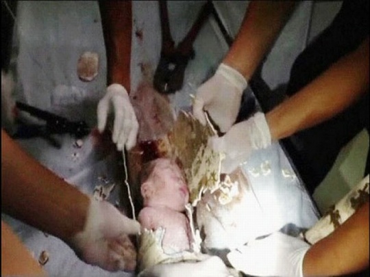 Newborn Baby Rescued from Toilet Pipe in China