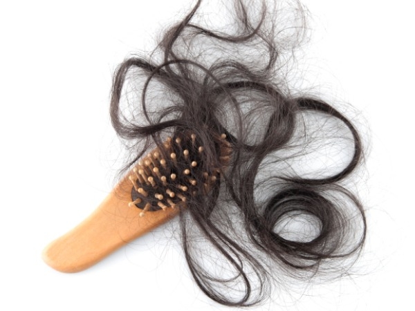 Causes Of Hair Fall: Hair Loss Linked To Iodine Deficiency?