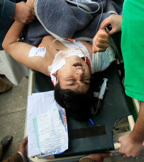 injured kid peshawar