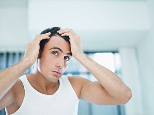 Major Hair Issues Men Face