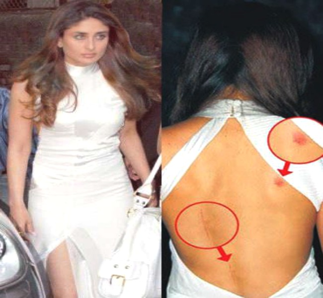 4. Kareena Kapoor's scar-y leaked images! 