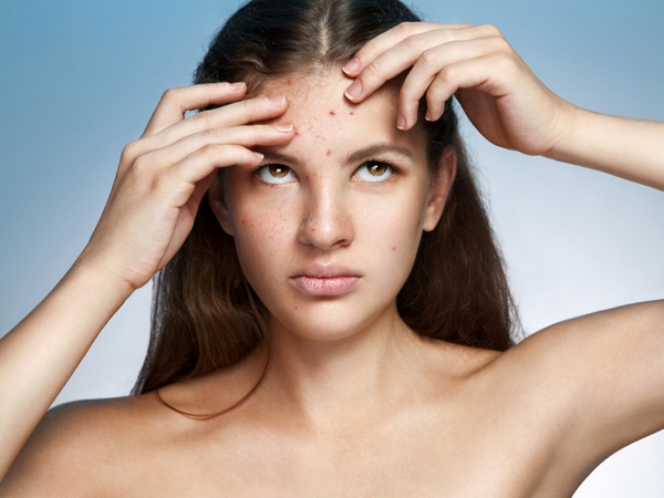 Unusual Treatments For Acne Scars