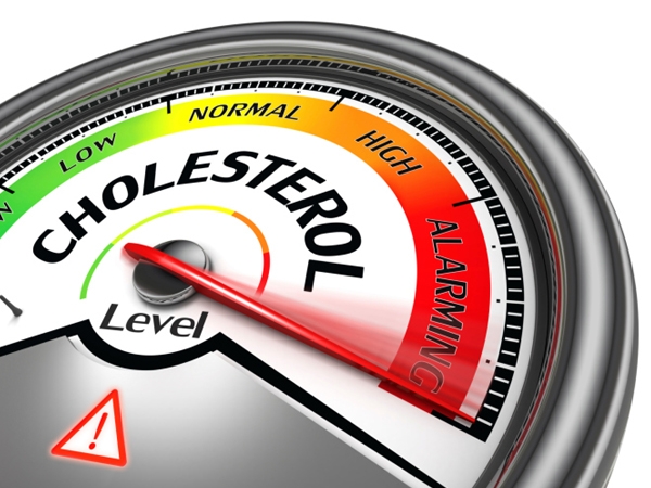 Managing Cholesterol Naturally
