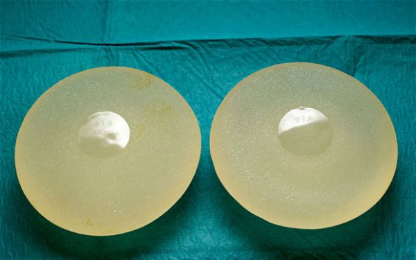 Cocaine Breast Implants