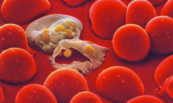 Malaria in blood