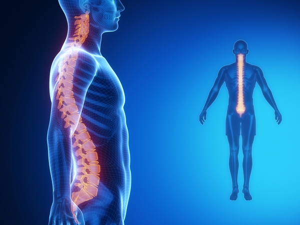 Lording It Out: How To Manage Hyperlordosis