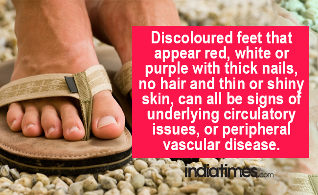 7 Health Conditions That Your Feet Can Warn You About!