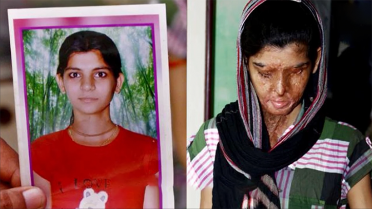 These Horrific Survivor Stories Of Acid Attack Victims Will Show You