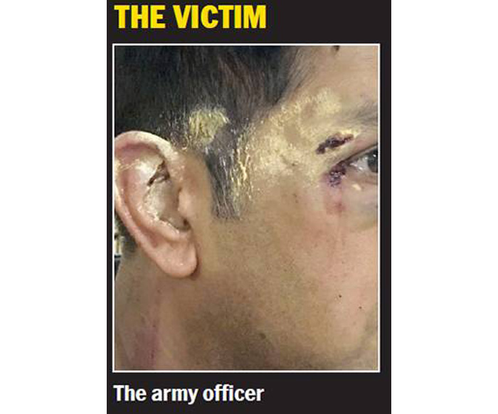 Army Officer Attacked By Bengaluru Locals In Road Rage For Being A 
