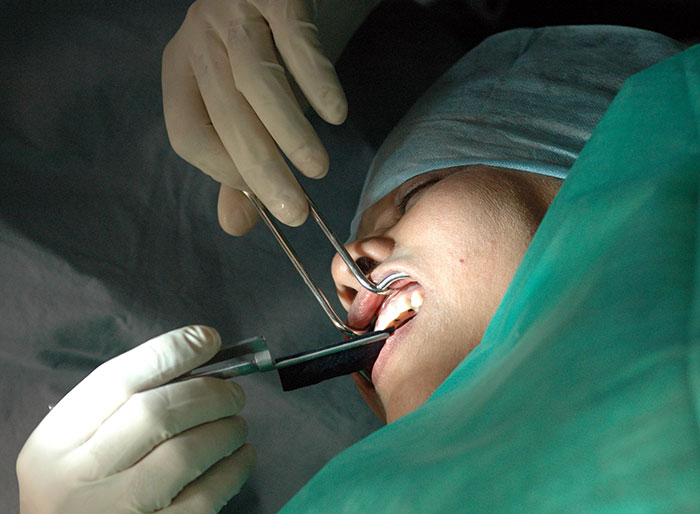 Dentist Removes Wrong Tooth, Slapped With 53k Fine