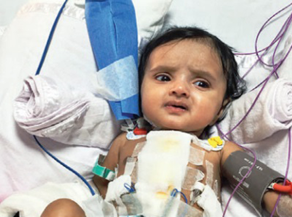 Four-Year-Old Mumbai Girl Survives Twenty Heart Attacks In Two Month