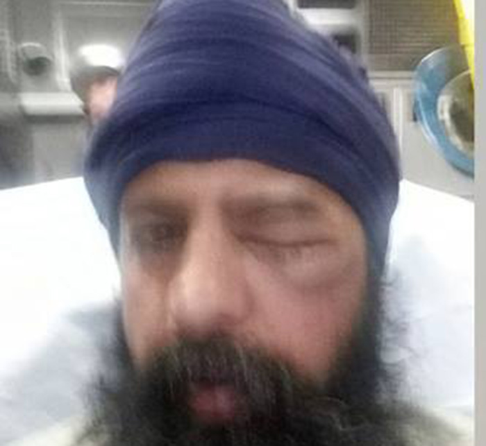 Sikh-American Brutally Assaulted, Turban Knocked Off, Hair Cut With Knife  In Alleged Hate Crime