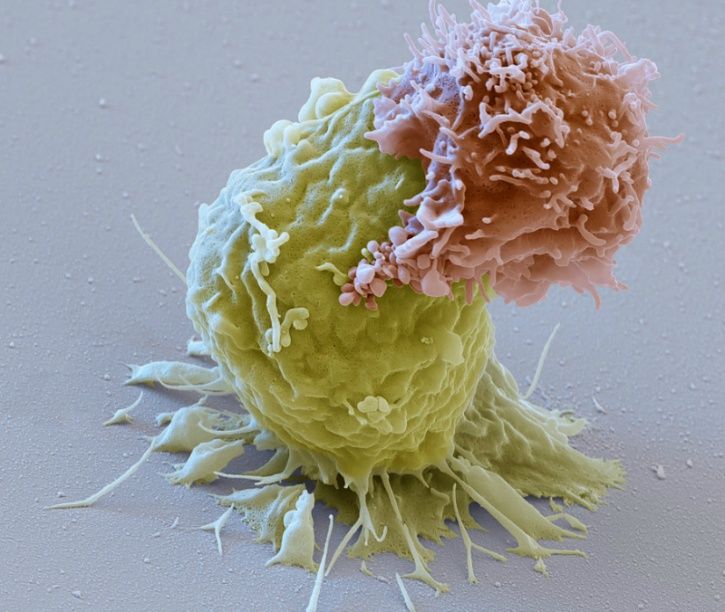 A new type of cancer treatment that uses genetically engineered cells to attack cancer cells is being pushed through for approval