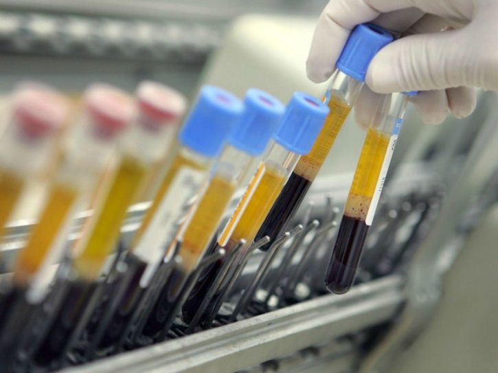 In a major breakthrough a research team lead by the Tokyo-based National Cancer Center Japan has developed a single blood test that can diagnose up to 13 types of cancers. With the center’s research committee have given the team a green signal to run a complete clinical study next month with the approval of the government. 