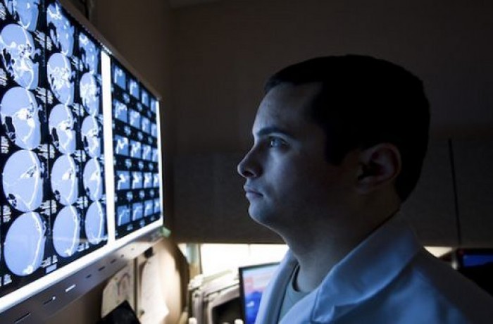The scientists took CT scans of 48 patients suffering from various diseases using a computer-based analysis that was able to predict the patients that would die within 5 years with 69 percent accuracy. The rate is comparable to manual predictions made by doctors
