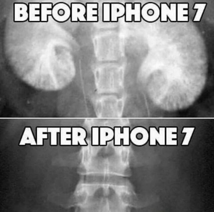 buying an iPhone is like selling a kidney