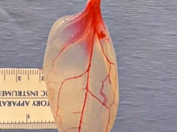 working heart tissue managed on a spinach leaf