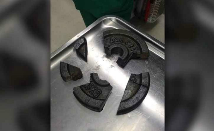 This Guy Got His Penis Stuck In A Weight Plate So Badly It Took