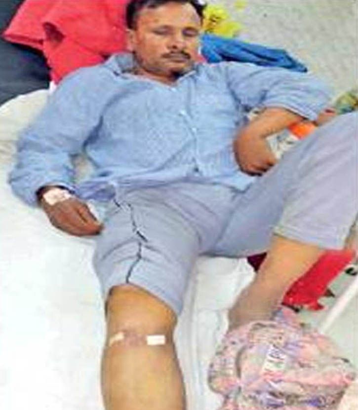 Delhi Surgeon Operates On Leg Of Patient With Head Injury