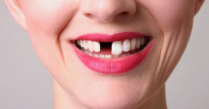 Lover Forces Woman To Remove 2 Teeth To Look Ugly