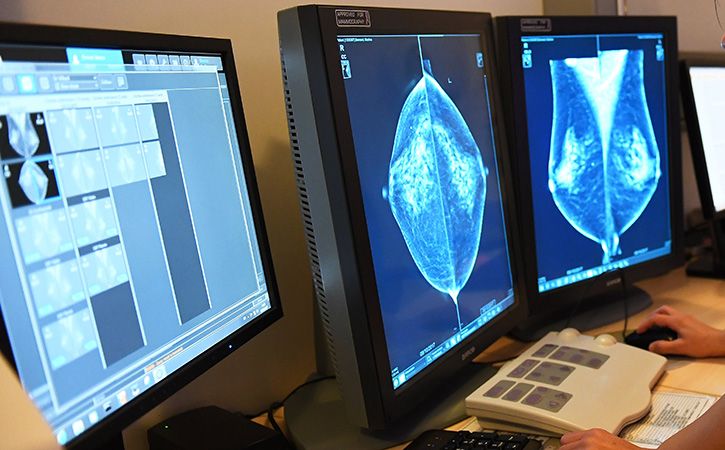 Breast Cancer Patients Can Skip Chemotherapy