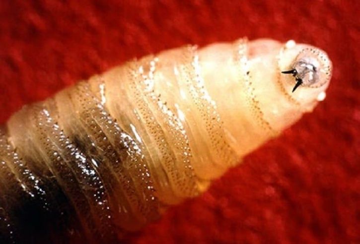 This Woman Discovered A Moving Bump Under Her Skin That Turned Out To Be A Parasitic Worm