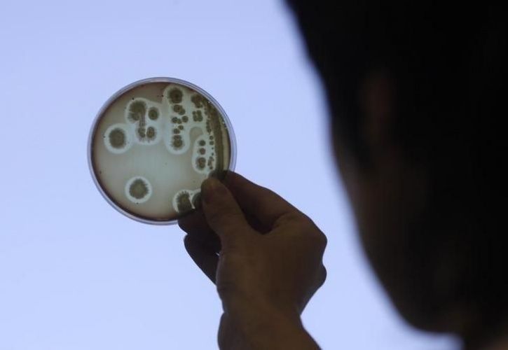 superbugs to kill millions by 2050