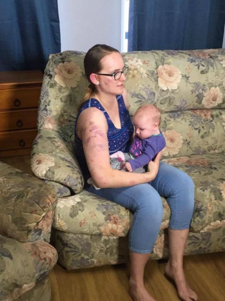 mom becomes human shield for baby, hailstorm