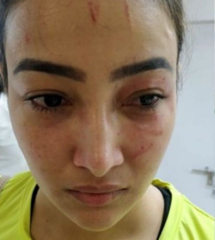 TV actress attacked by roommate Preeti Rana.