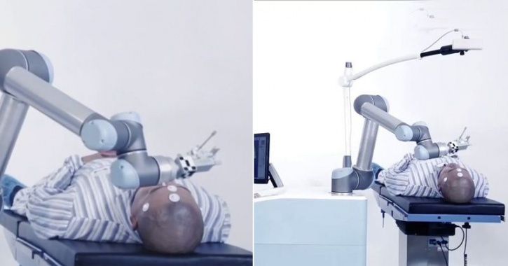 Meet Remebot, China’s First Neurosurgery Robot