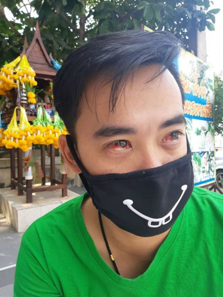 Thailand smog, Thailand air pollution, people bleeding, coughing blood, blood, smog, air pollution
