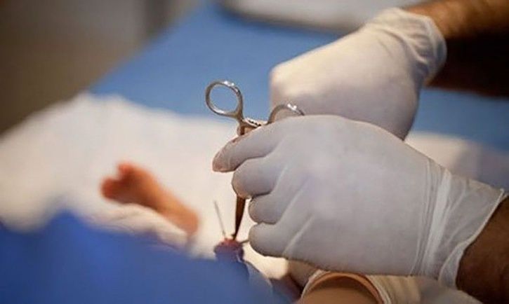 Botched Circumcision Kerala