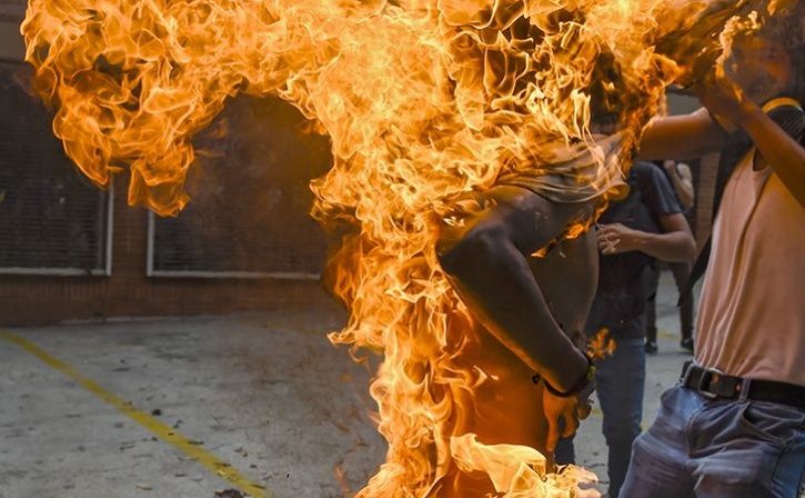 Mistaken For A Thief Dalit Man Set Afire In UP
