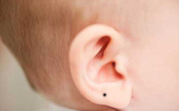 शरीर के Til ka matlab | Mole Meaning in hindi: किसी भी भाग पर मौजूद तिल