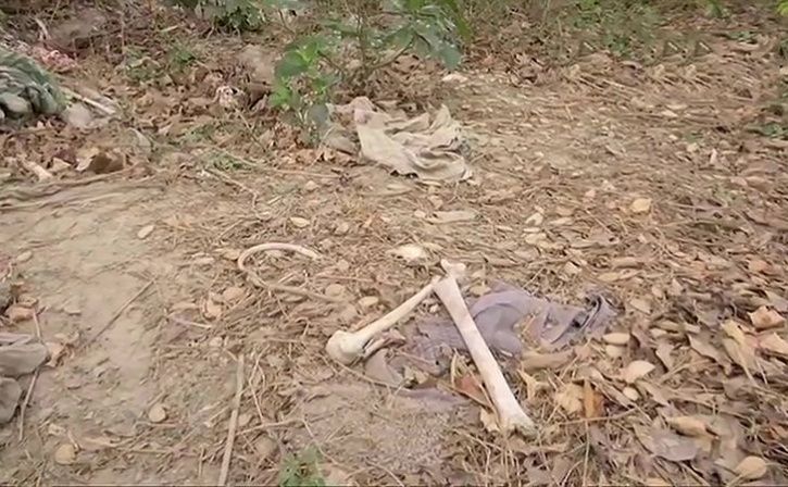 human skeleton found dumped near hospital