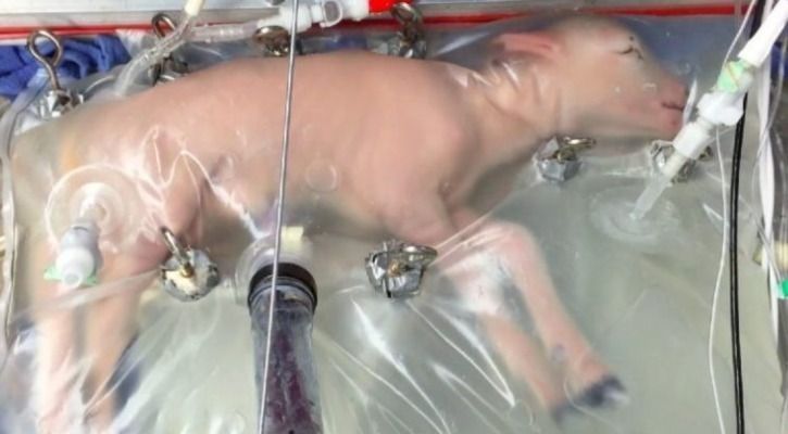 artificial womb
